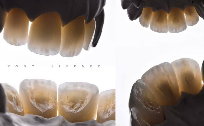 Как стоматолог-ортопед решает какая коронка подойдет в вашем случае?