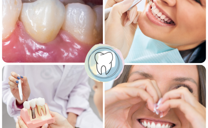 Как сохранить здоровье и не тратиться на лечение зубов?